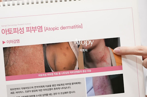 생기한의원이 안내하는 아토피 피부 변화 지속 시 진료 확인 방법
